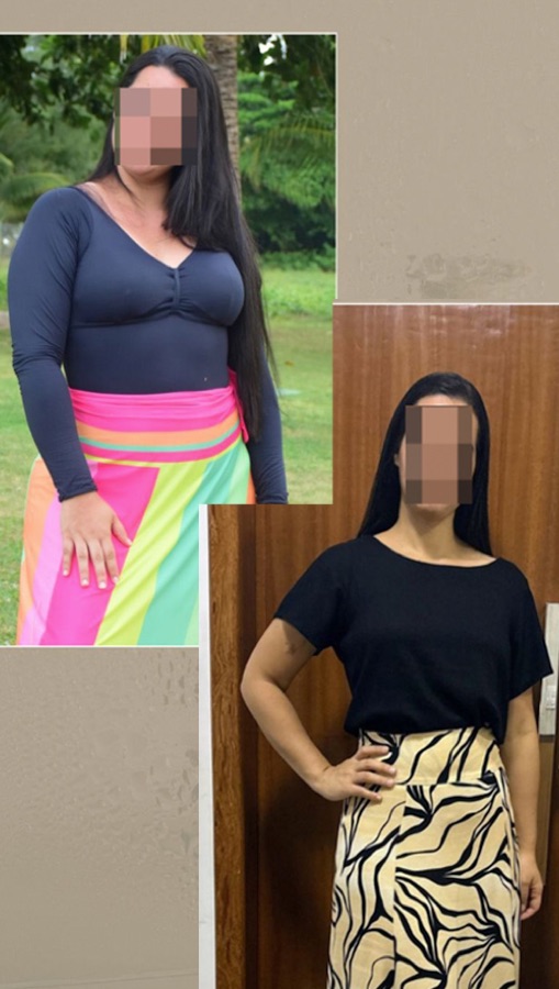 Paciente do Núcleo Neres, antes e depois do acompanhamento