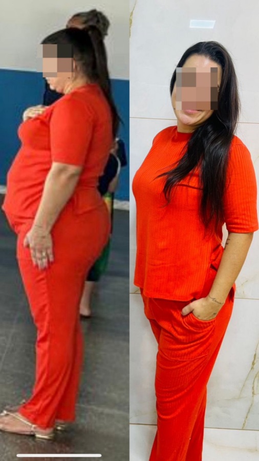 Paciente do Núcleo Neres, antes e depois do acompanhamento