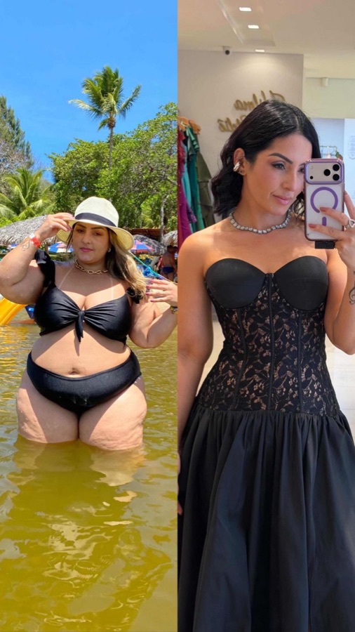 Paciente do Núcleo Neres, antes e depois do acompanhamento