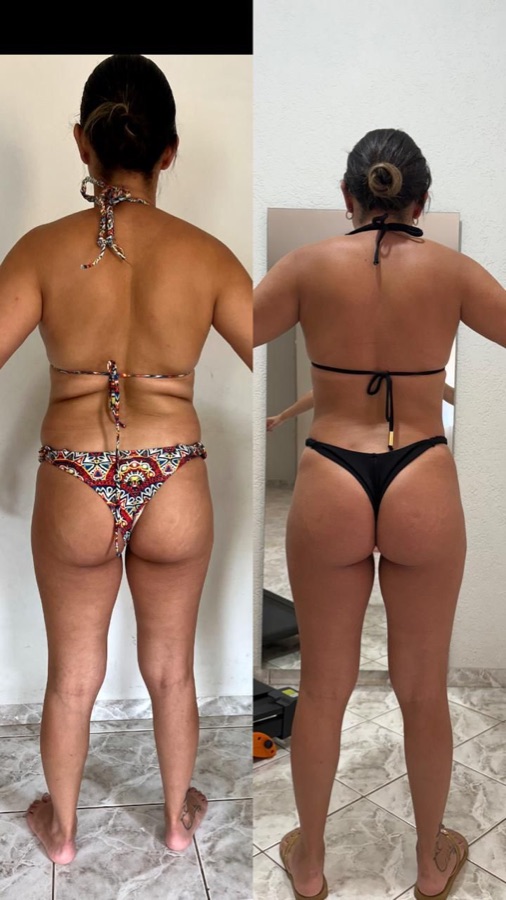 Paciente do Núcleo Neres, antes e depois do acompanhamento